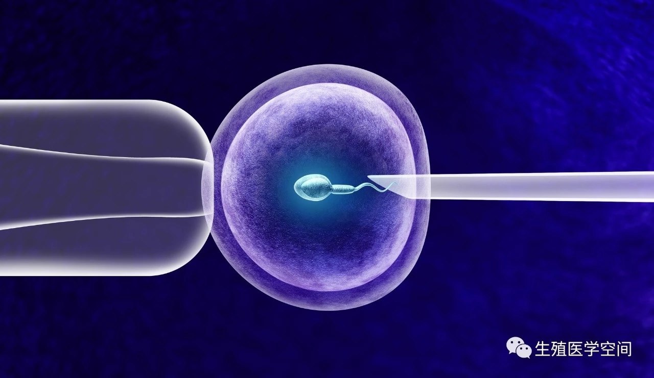 高龄女性生育风险：50岁做试管婴儿需谨慎考虑