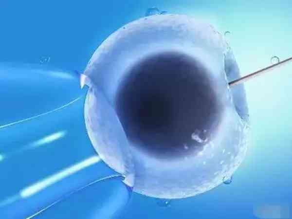 高龄备孕与女性卵巢功能衰退的相关性研究