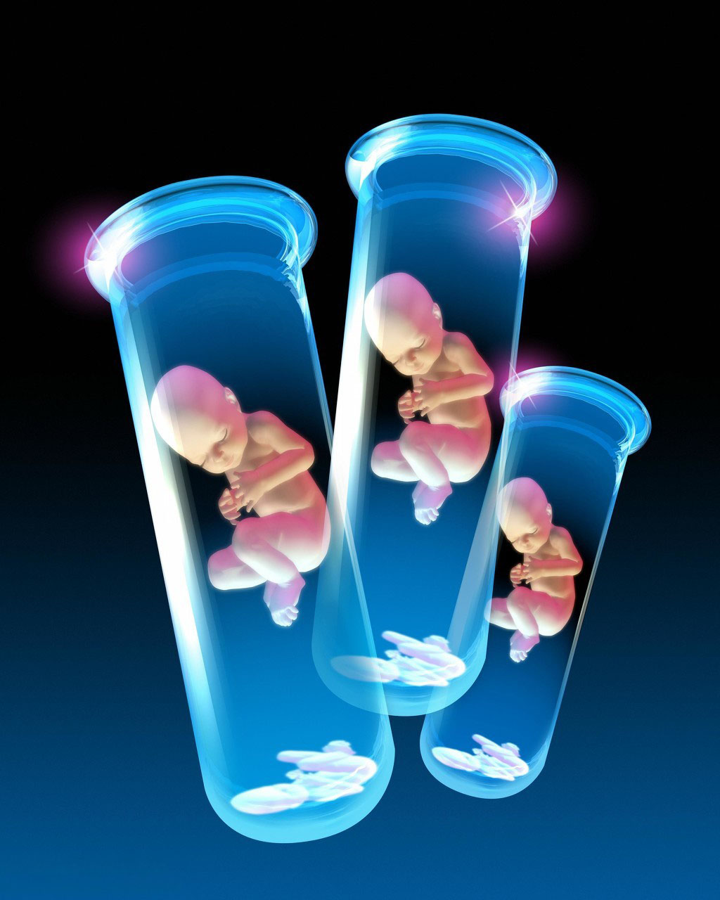 高龄产妇生育风险解读：分析谢娜选择试管婴儿的原因